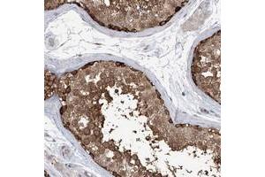 Immunohistochemical staining of human testis with KAAG1 polyclonal antibody  shows strong positivity in a subset of cells in seminiferus ducts at 1:50-1:200 dilution. (KAAG1 Antikörper)