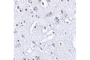 Immunohistochemistry of TIGAR in human brain tissue with TIGAAP30878PU-N at 2. (TIGAR Antikörper  (Center))