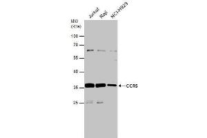WB Image Various whole cell extracts (30 μg) were separated by 10% SDS-PAGE, and the membrane was blotted with CCR5 antibody , diluted at 1:500. (CCR5 Antikörper  (Center))