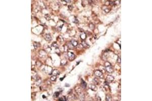 Image no. 1 for anti-Bone Morphogenetic Protein 3 (BMP3) (N-Term) antibody (ABIN357181) (BMP3 Antikörper  (N-Term))