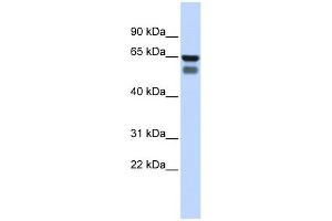 GALNT4 antibody used at 1 ug/ml to detect target protein. (GALNT4 Antikörper)