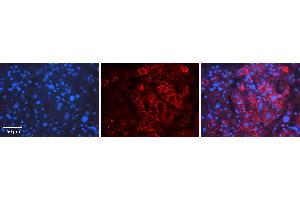 Rabbit Anti-ID2 Antibody   Formalin Fixed Paraffin Embedded Tissue: Human Liver Tissue Observed Staining: Cytoplasm Primary Antibody Concentration: 1:100 Other Working Concentrations: 1:600 Secondary Antibody: Donkey anti-Rabbit-Cy3 Secondary Antibody Concentration: 1:200 Magnification: 20X Exposure Time: 0. (Id2 Antikörper  (Middle Region))