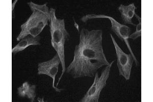 Immunofluorescent staining of U-87 MG (ATCC HTB-14) cells.