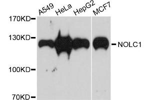 Western blot analysis of extracts of various cells, using NOLC1 antibody. (NOLC1 Antikörper)