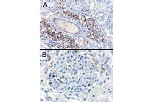 Image no. 1 for anti-SH3-Domain Binding Protein 1 (SH3BP1) (C-Term) antibody (ABIN374404) (SH3BP1 Antikörper  (C-Term))