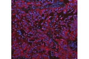 IF analysis of Cytokeratin 19 using anti-Cytokeratin 19 antibody (ABIN3043288).