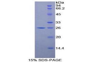 SDS-PAGE analysis of Mouse LMP7 Protein. (PSMB8 Protein)