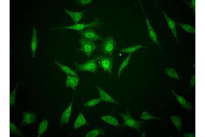 Immunofluorescent staining of human cell lines. (TAZ Antikörper)