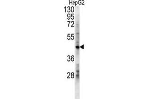Western Blotting (WB) image for anti-Lactate Dehydrogenase D (LDHD) antibody (ABIN3002427)