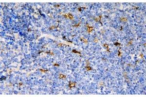 IHC analysis of CCR6 using anti-CCR6 antibody (ABIN7603110). (CCR6 Antikörper  (N-Term))