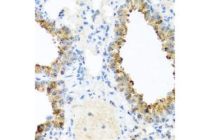 Immunohistochemistry of paraffin-embedded mouse lung using NIN antibody at dilution of 1:100 (x40 lens). (Ninein Antikörper)