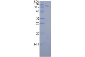 SDS-PAGE analysis of Human FKBP5 Protein. (FKBP5 Protein)