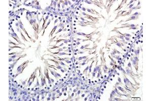 Paraformaldehyde-fixed, paraffin embedded Rat testis tissue, Antigen retrieval by boiling in sodium citrate buffer(pH6) for 15min, Block endogenous peroxidase by 3% hydrogen peroxide for 20 minutes, Blocking buffer (normal goat serum) at 37°C for 30min, Antibody incubation with STIL Polyclonal Antibody, Unconjugated  at 1:400 overnight at 4°C, followed by a conjugated secondary and DAB staining (STIL Antikörper)