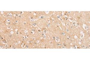 Immunohistochemistry of paraffin-embedded Human brain tissue using C15orf40 Polyclonal Antibody at dilution of 1:30(x200) (C15orf40 Antikörper)