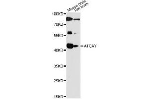 Western blot analysis of extracts of various cell lines, using ATCAY antibody (ABIN6292798) at 1:1000 dilution. (ATCAY Antikörper)
