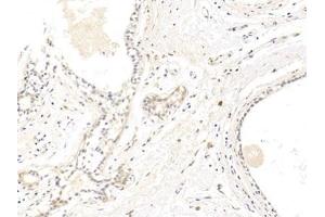 Immunohistochemistry (IHC) image for anti-Claudin 1 (CLDN1) (AA 50-197) antibody (ABIN7434863)