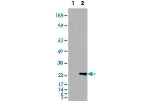 HEK293 overexpressing BDH2 and probed with BDH2 polyclonal antibody  (mock transfection in first lane), tested by Origene. (BDH2 Antikörper  (Internal Region))