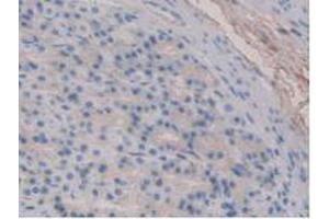 IHC-P analysis of Rat Stomach Tissue, with DAB staining. (Fibrillin 1 Antikörper  (AA 751-895))