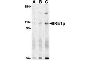 Western blot analysis of IRE1p in A-20 cell lysate with AP30445PU-N IRE1p antibody at (A) 0. (ERN1 Antikörper  (N-Term))