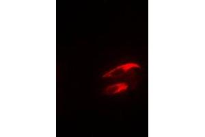 Immunofluorescent analysis of Focal Adhesion Kinase (pY925) staining in NIH3T3 cells. (FAK Antikörper  (C-Term, pTyr925))