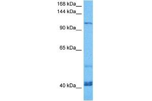 Host:  Mouse  Target Name:  KIF23  Sample Tissue:  Mouse Spleen  Antibody Dilution:  1ug/ml (KIF23 Antikörper  (Middle Region))
