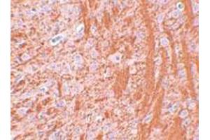 Immunohistochemical staining of rat brain tissue with 2.