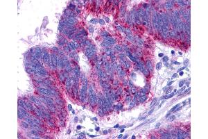 Immunohistochemistry (IHC) image for anti-Endothelin Receptor Type B (EDNRB) (N-Term) antibody (ABIN1048557)