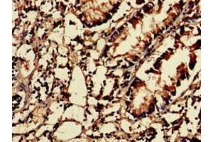 Immunohistochemistry of paraffin-embedded human appendix tissue using ABIN7142858 at dilution of 1:100 (NUDT1 Antikörper  (AA 49-82))