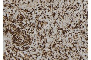 ABIN6277757 at 1/100 staining Human gastric tissue by IHC-P. (PVALB Antikörper  (C-Term))