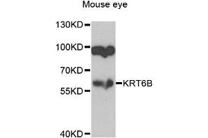 Western blot analysis of extracts of mouse eye, using KRT6B antibody (ABIN5974464) at 1/1000 dilution. (Keratin 6B Antikörper)