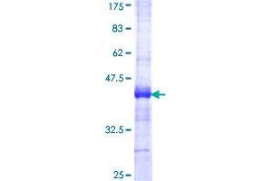 Image no. 1 for Acetyl-CoA Carboxylase alpha (ACACA) (AA 1-99) protein (GST tag) (ABIN1305570) (Acetyl-CoA Carboxylase alpha Protein (ACACA) (AA 1-99) (GST tag))