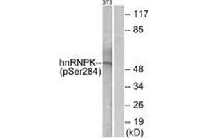 Western blot analysis of extracts from NIH-3T3 cells treated with EGF 200ng/ml 30', using hnRNP K (Phospho-Ser284) Antibody.