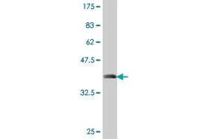 Western Blot detection against Immunogen (37 KDa) . (FLT4 Antikörper  (AA 34-133))