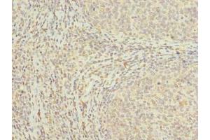 Immunohistochemistry of paraffin-embedded human tonsil tissue using ABIN7159116 at dilution of 1:100