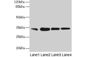 Western blot All lanes: RAD23A antibody at 3 μg/mL Lane 1: MCF-7 whole cell lysate Lane 2: Hela whole cell lysate Lane 3: Raji whole cell lysate Lane 4: Jurkat whole cell lysate Secondary Goat polyclonal to rabbit IgG at 1/10000 dilution Predicted band size: 40, 34 kDa Observed band size: 34 kDa (RAD23A Antikörper  (AA 2-201))