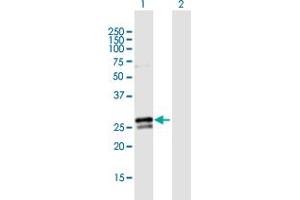 Western Blot analysis of RAB3B expression in transfected 293T cell line by RAB3B MaxPab polyclonal antibody. (RAB3B Antikörper  (AA 1-219))