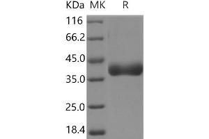 Western Blotting (WB) image for Cathepsin B (CTSB) protein (His tag) (ABIN7321072) (Cathepsin B Protein (CTSB) (His tag))