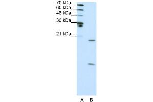 WB Suggested Anti-SNRPF Antibody Titration:  0. (SNRPF Antikörper  (N-Term))