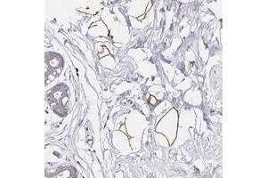 Immunohistochemical staining of human breast with C19orf12 polyclonal antibody  shows strong positivity in adipocytes at 1:50-1:200 dilution. (C19ORF12 Antikörper)