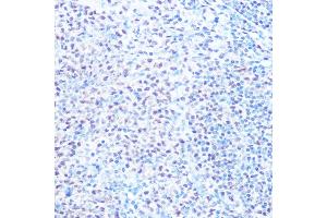 Immunohistochemistry of paraffin-embedded rat spleen using SNRPB Rabbit pAb (ABIN6134519, ABIN6148214, ABIN6148215 and ABIN6219175) at dilution of 1:100 (40x lens). (SNRPB Antikörper  (AA 1-100))