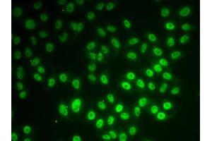 Immunofluorescence analysis of MCF7 cell using SNRPD1 antibody. (SNRPD1 Antikörper)