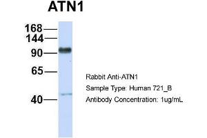 Host: Rabbit Target Name: ATN1 Sample Type: 721_B Antibody Dilution: 1. (Atrophin 1 Antikörper  (N-Term))