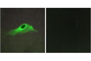 Immunofluorescence analysis of HeLa cells, using COL4A5 antibody. (COL4a5 Antikörper  (N-Term))