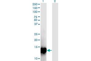 Western Blot analysis of C17orf37 expression in transfected 293T cell line by C17orf37 monoclonal antibody (M09), clone 4D4. (C17orf37 Antikörper  (AA 1-115))