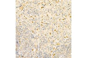 Immunohistochemistry of paraffin embedded rat spleen using RAPGEF5 (ABIN7075365) at dilution of 1:700 (400x lens) (GFR Antikörper)