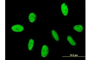 Immunofluorescence of purified MaxPab antibody to GTF2IRD2 on HeLa cell. (GTF2IRD2 Antikörper  (AA 1-498))