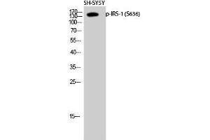 Western Blot (WB) analysis of SH-SY5Y cells using Phospho-IRS-1 (S636) Polyclonal Antibody. (IRS1 Antikörper  (pSer636))