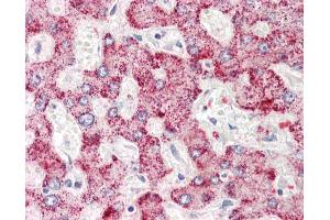 Anti-AIG1 antibody IHC staining of human liver. (AIG1 Antikörper  (N-Term))