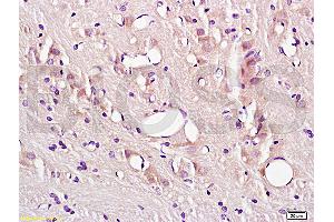 Formalin-fixed and paraffin embedded rat brain tissue labeled with Anti-CD54/ICAM-1 Polyclonal Antibody (ABIN670806), Unconjugated at 1:200, followed by conjugation to the secondary antibody and DAB staining (ICAM1 Antikörper  (AA 201-300))