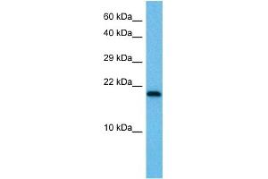 Host:  Mouse  Target Name:  UBE2I  Sample Tissue:  Mouse Testis  Antibody Dilution:  1ug/ml (UBE2I Antikörper  (N-Term))